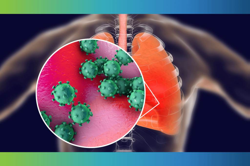 Medical illustration showing lung infection and respiratory virus concept